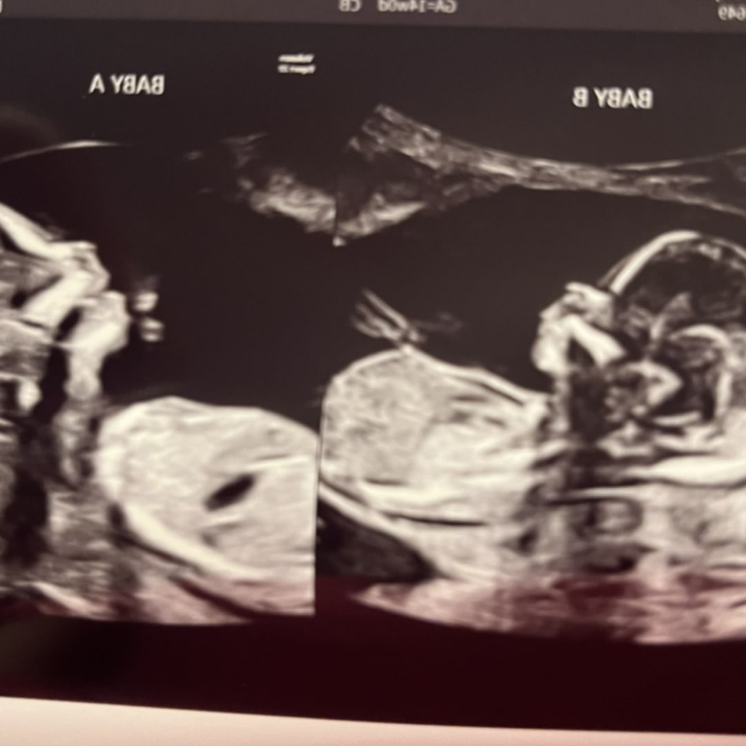 Photo shared by Alyssa for their Babylist baby registry.