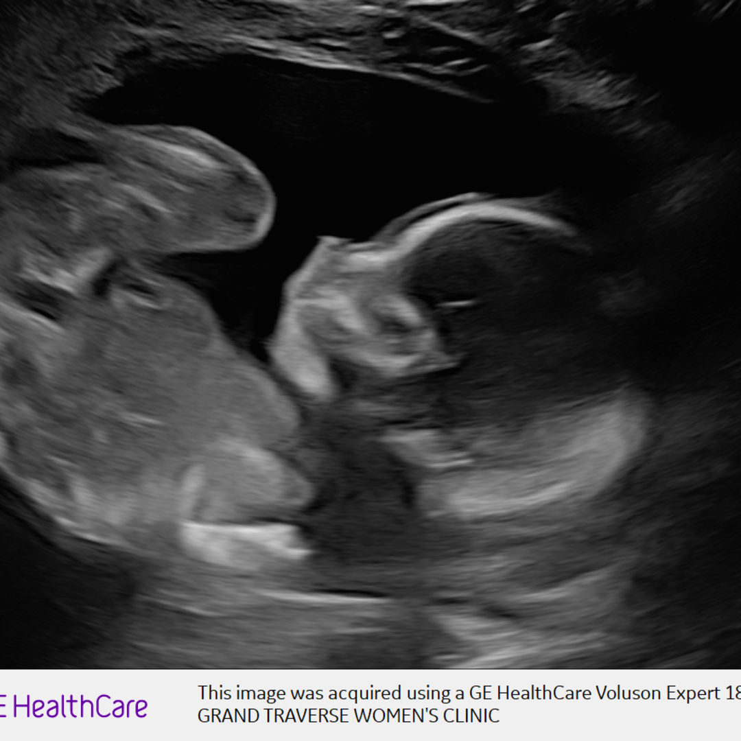 Photo shared by Hannah for their Babylist baby registry.