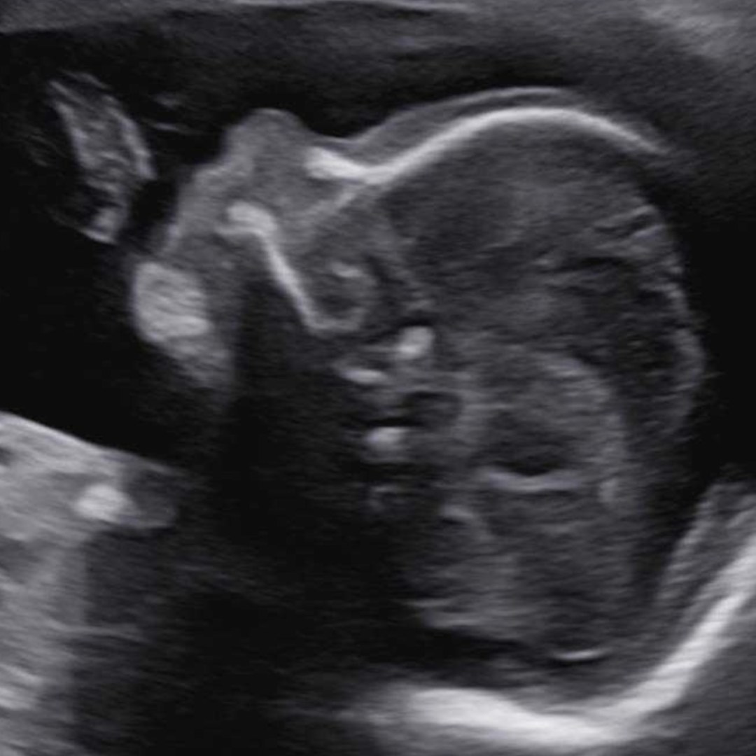 Photo shared by Paige for their Babylist baby registry.