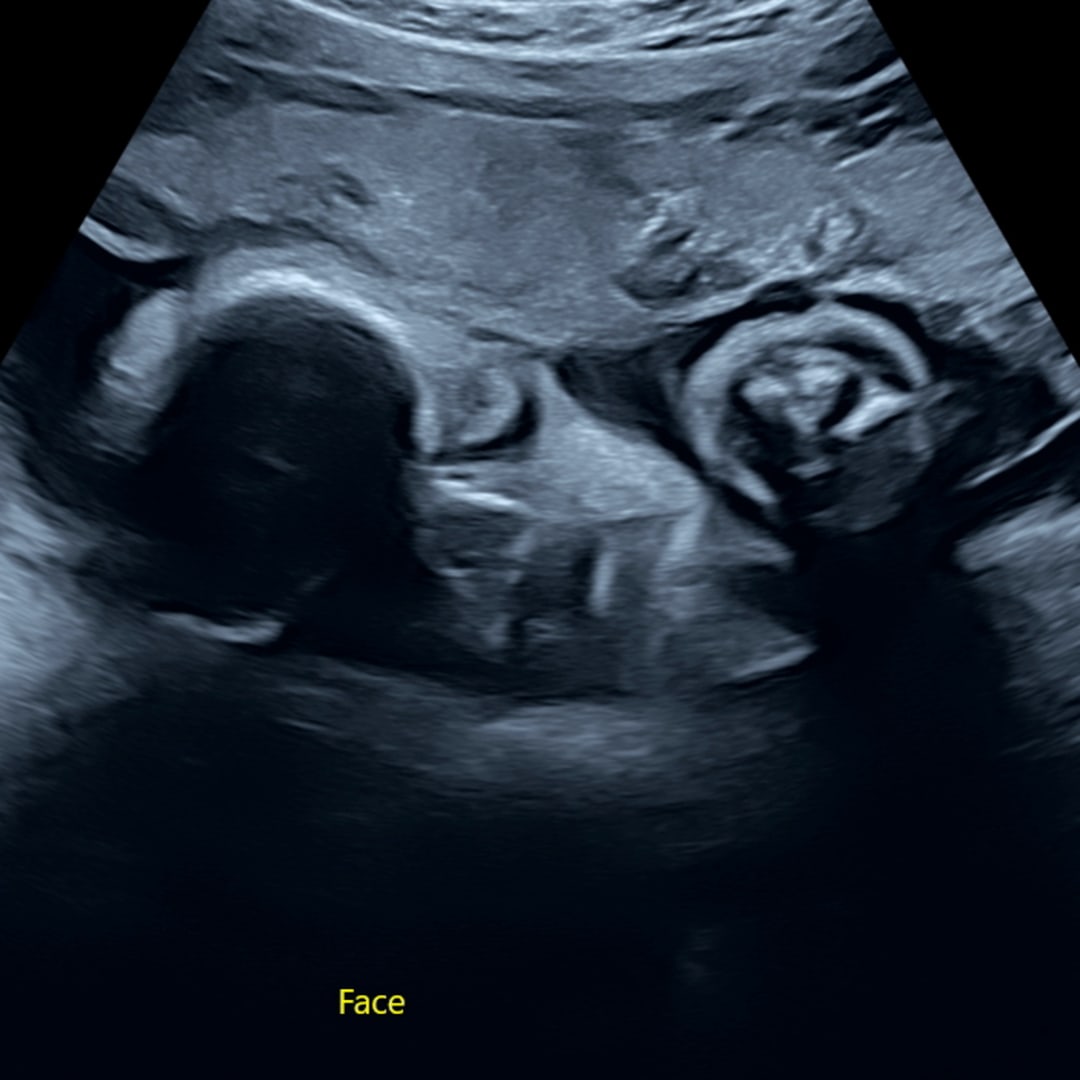 Photo shared by Franciris for their Babylist baby registry.