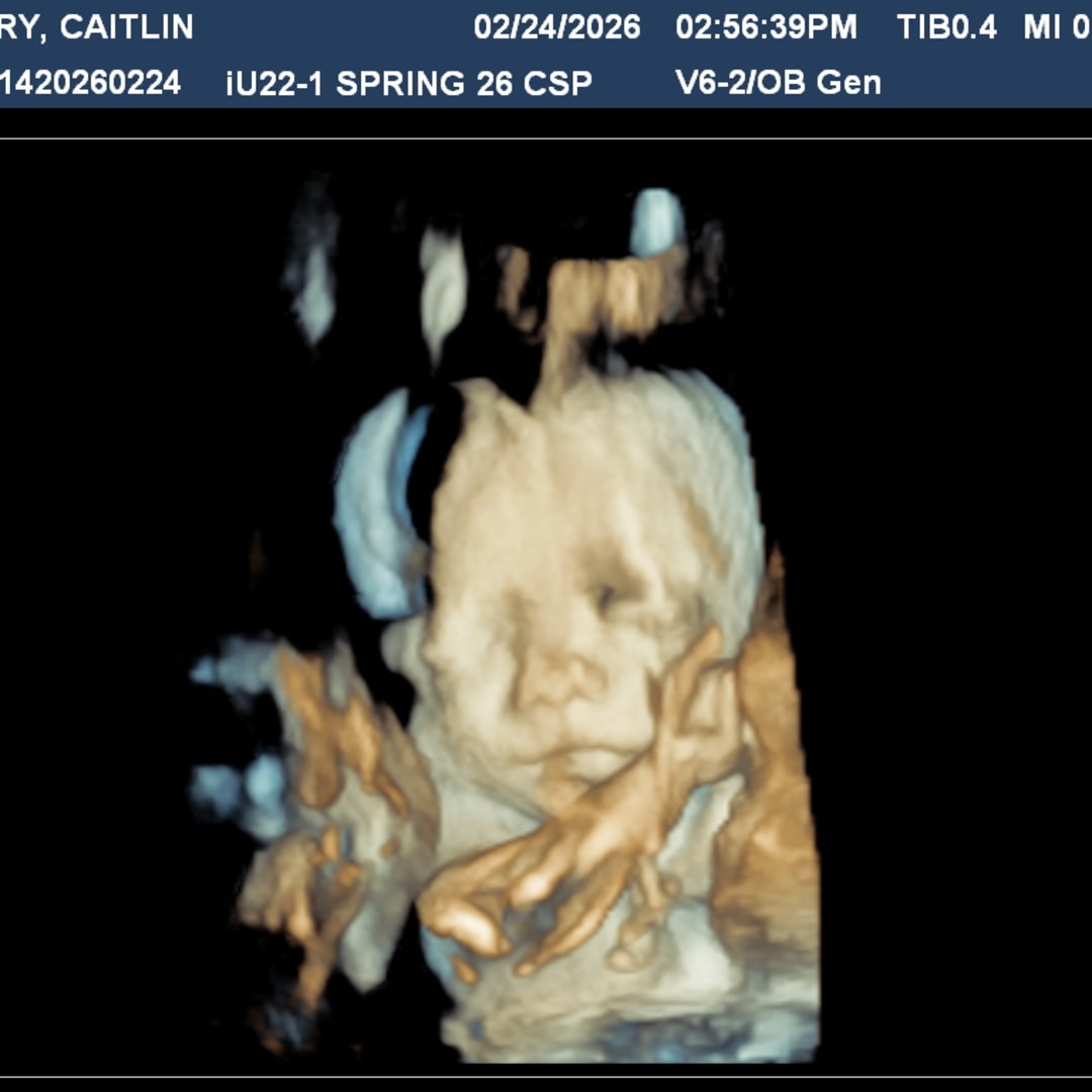 Photo shared by Caitlin for their Babylist baby registry.