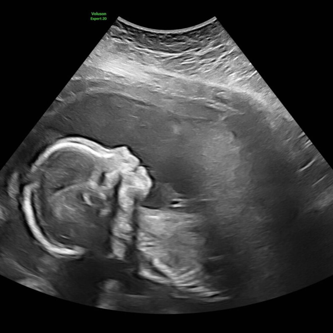 Photo shared by Ariel for their Babylist baby registry.