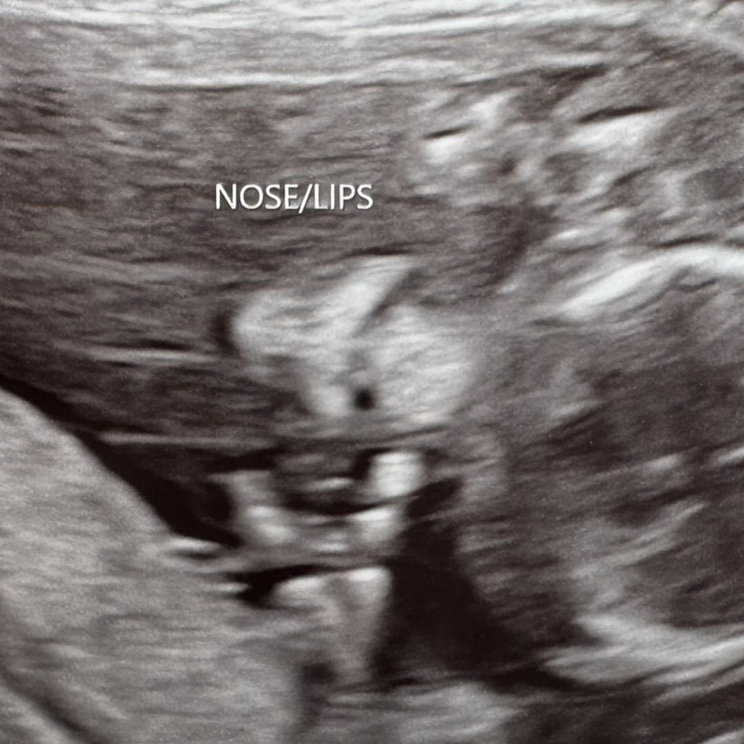 Photo shared by Kennedy for their Babylist baby registry.