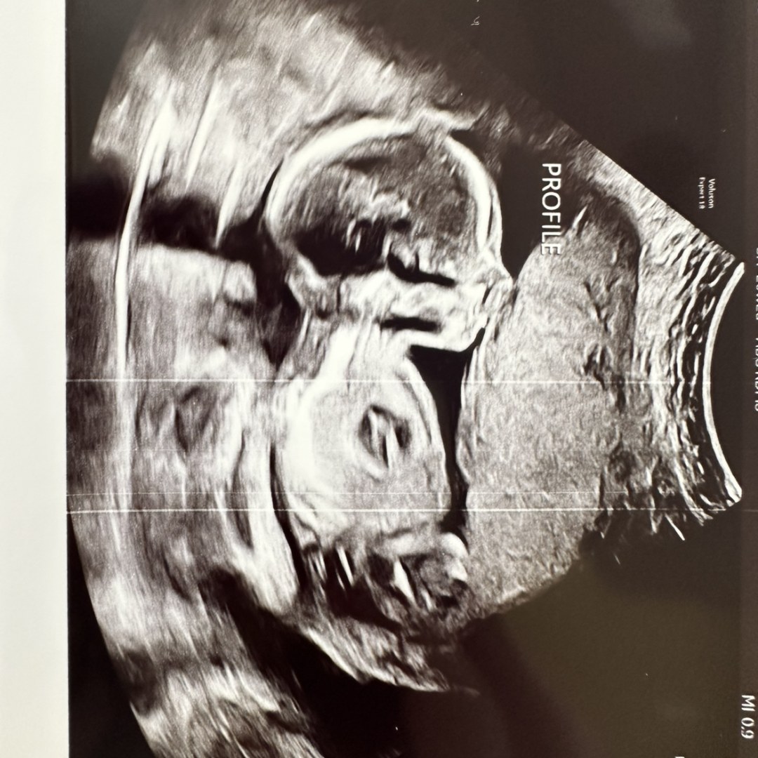 Photo shared by Karla for their Babylist baby registry.