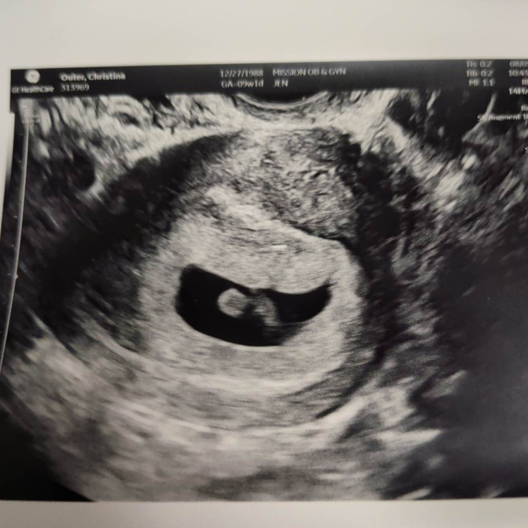 Photo shared by Christina for their Babylist baby registry.