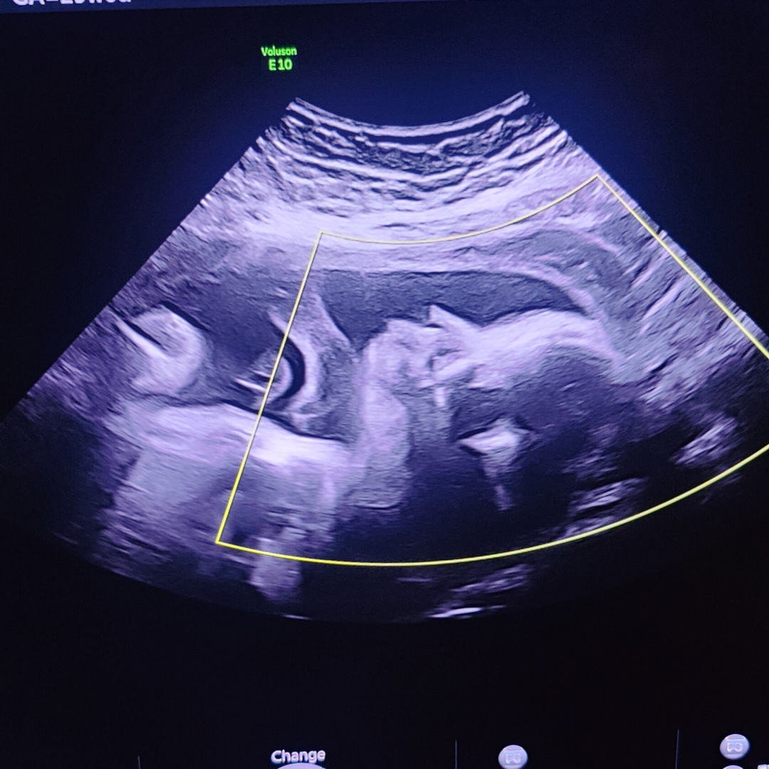 Photo shared by Emma for their Babylist baby registry.