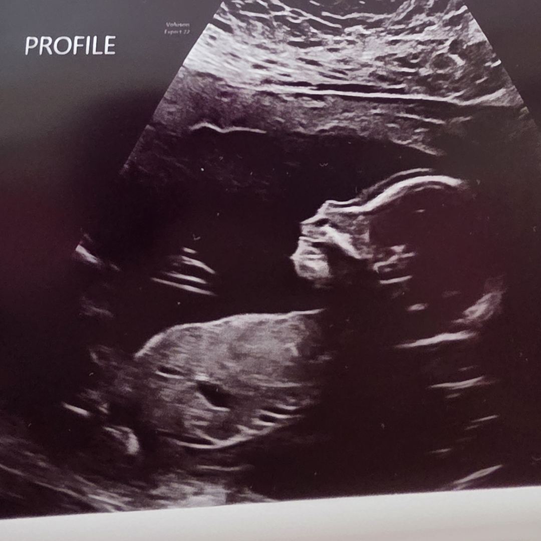 Photo shared by Cheyanne for their Babylist baby registry.