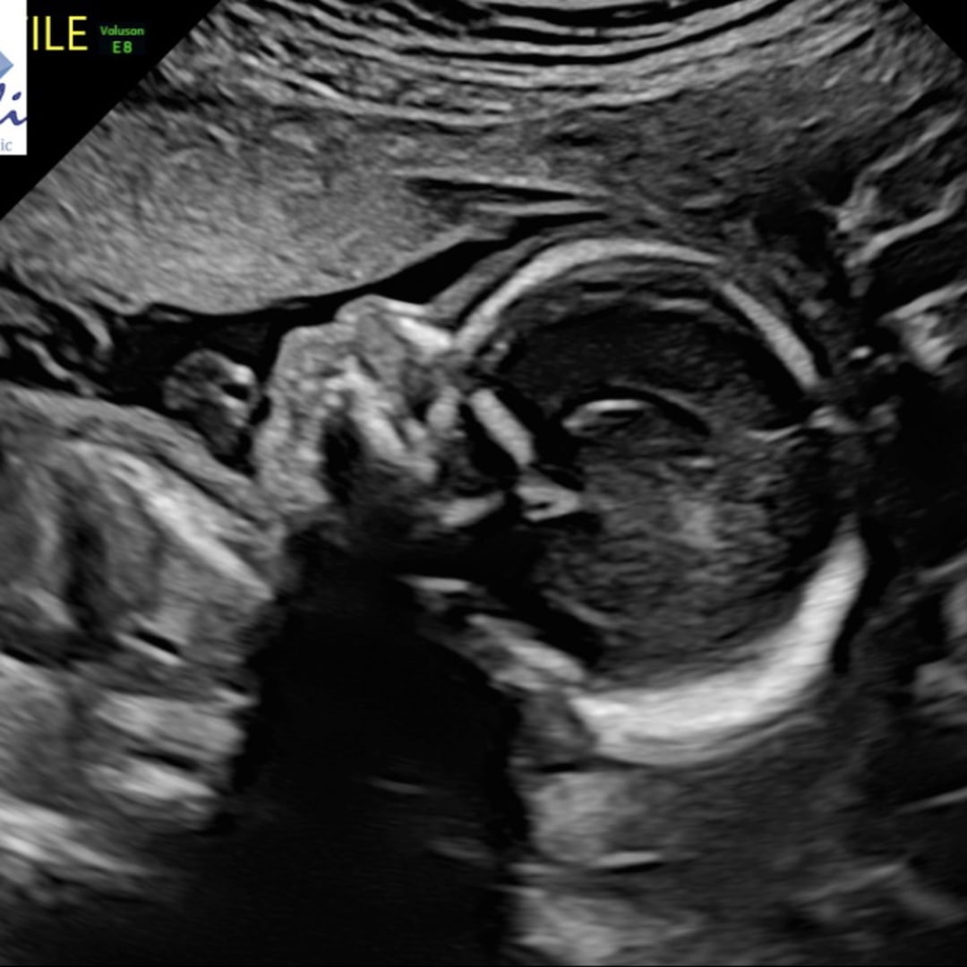 Photo shared by Alissa for their Babylist baby registry.