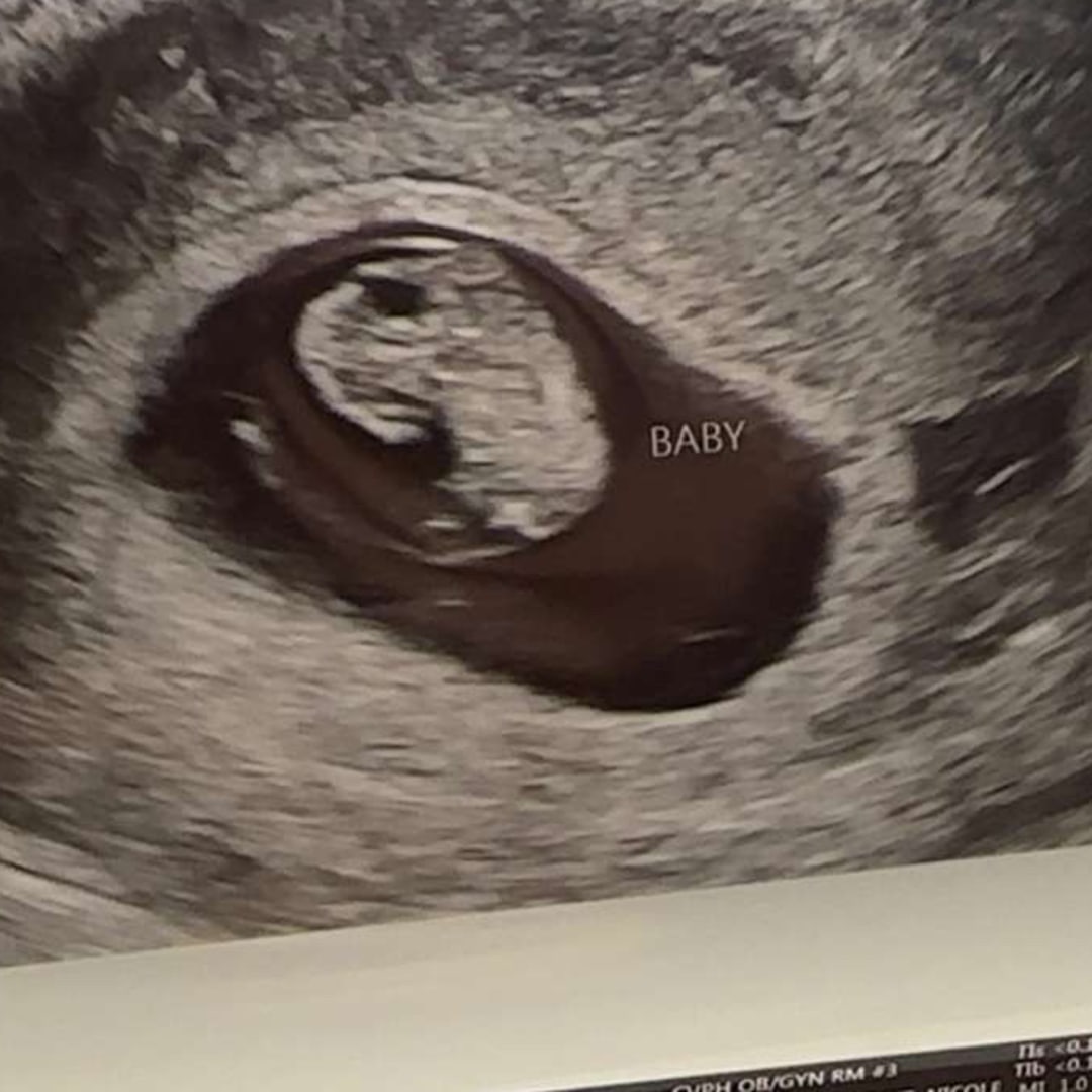 Photo shared by Mia for their Babylist baby registry.