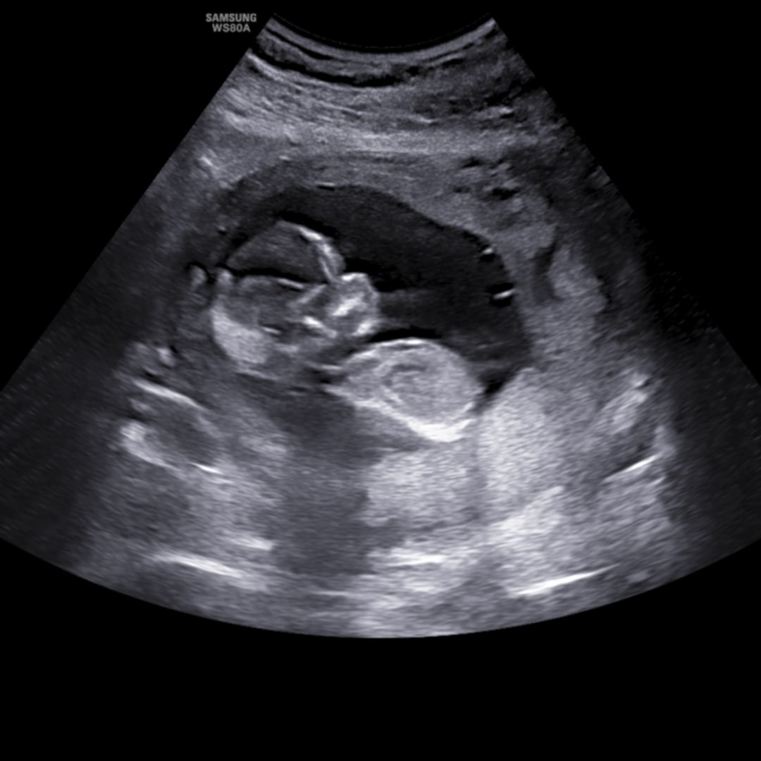 Photo shared by Jenna for their Babylist baby registry.