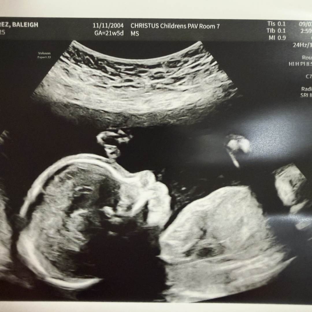 Photo shared by Baleigh for their Babylist baby registry.