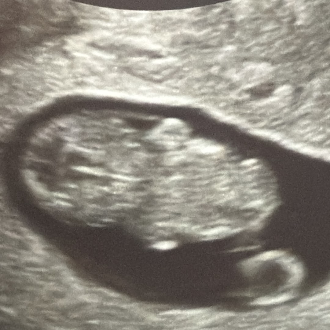 Photo shared by Dahara for their Babylist baby registry.