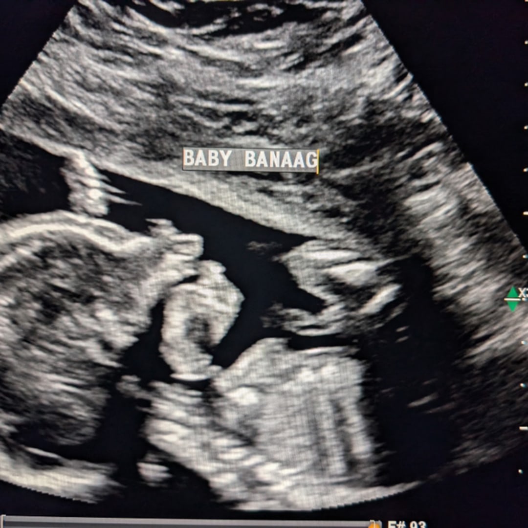 Photo shared by Talya for their Babylist baby registry.