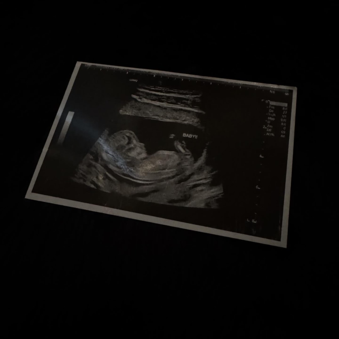 Photo shared by Mimi for their Babylist baby registry.