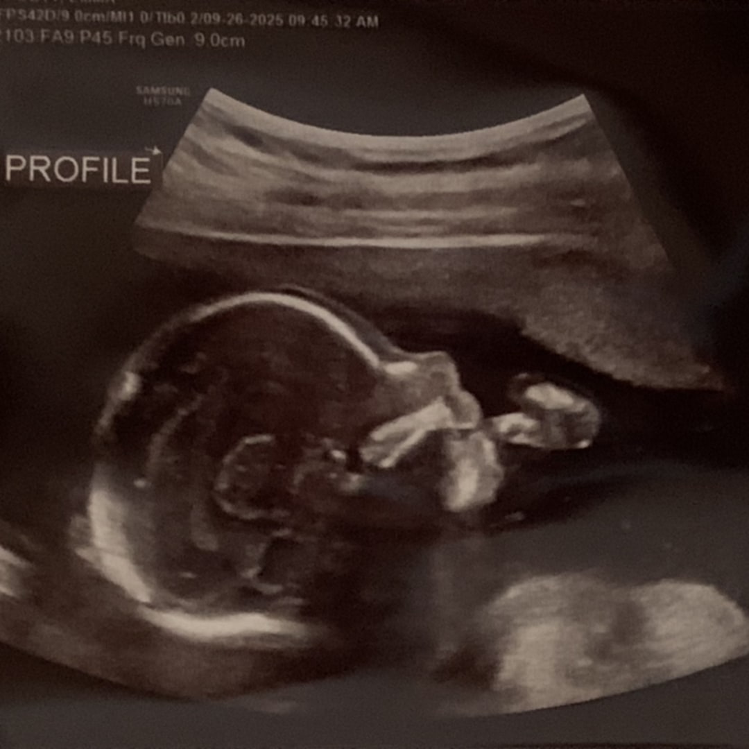 Photo shared by Emma for their Babylist baby registry.