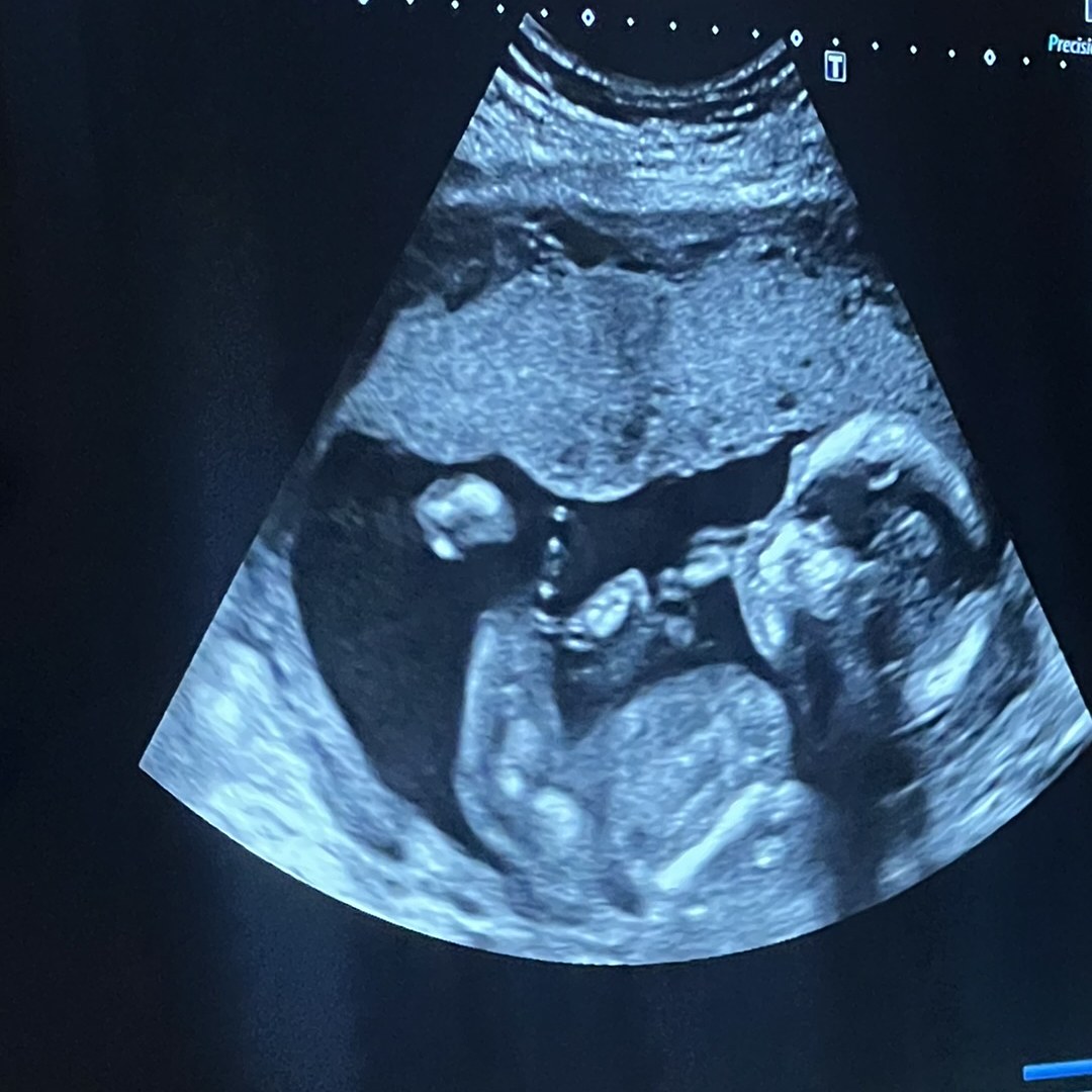 Photo shared by Edith for their Babylist baby registry.