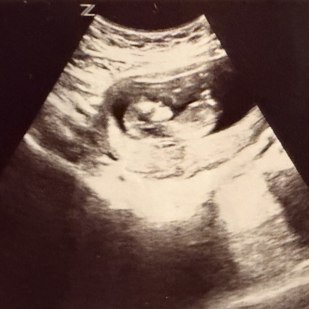 Photo shared by Charlie for their Babylist baby registry.