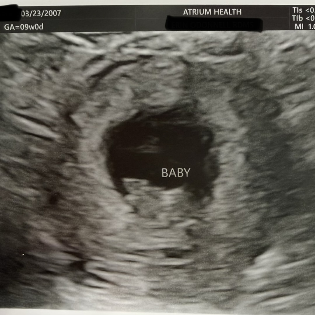 Photo shared by Ashryn for their Babylist baby registry.