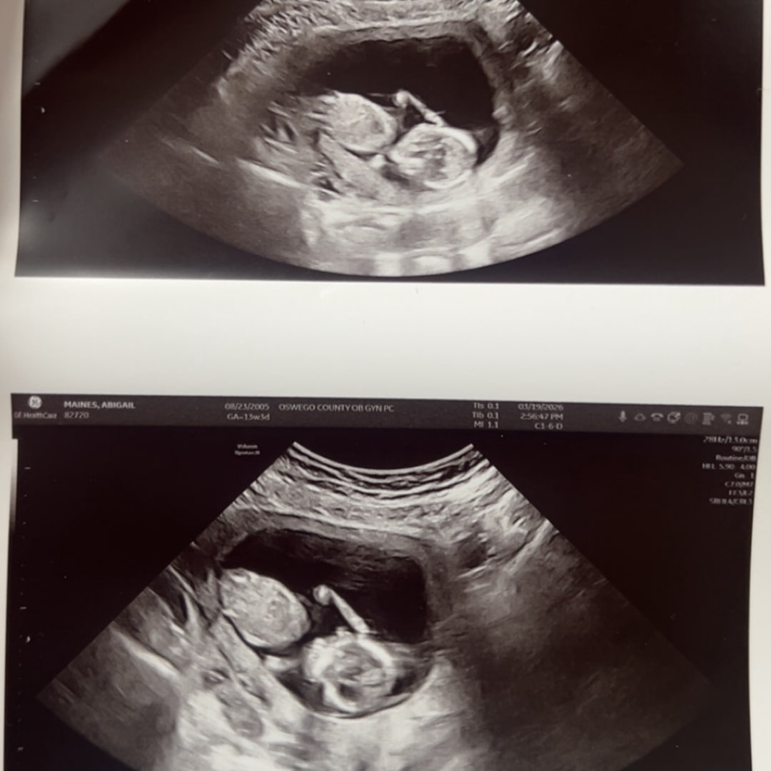 Photo shared by Abigail for their Babylist baby registry.