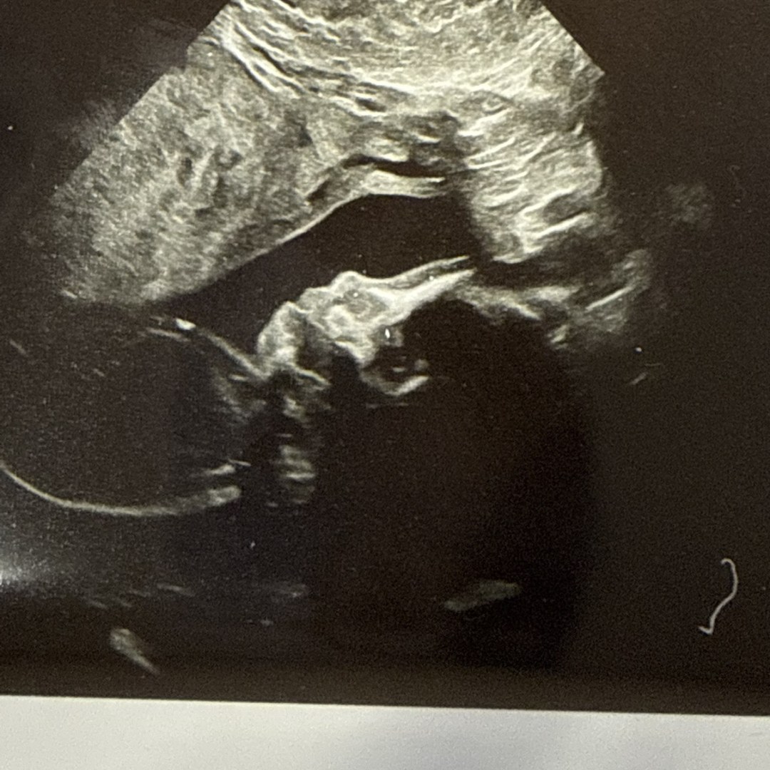 Photo shared by Naomi for their Babylist baby registry.