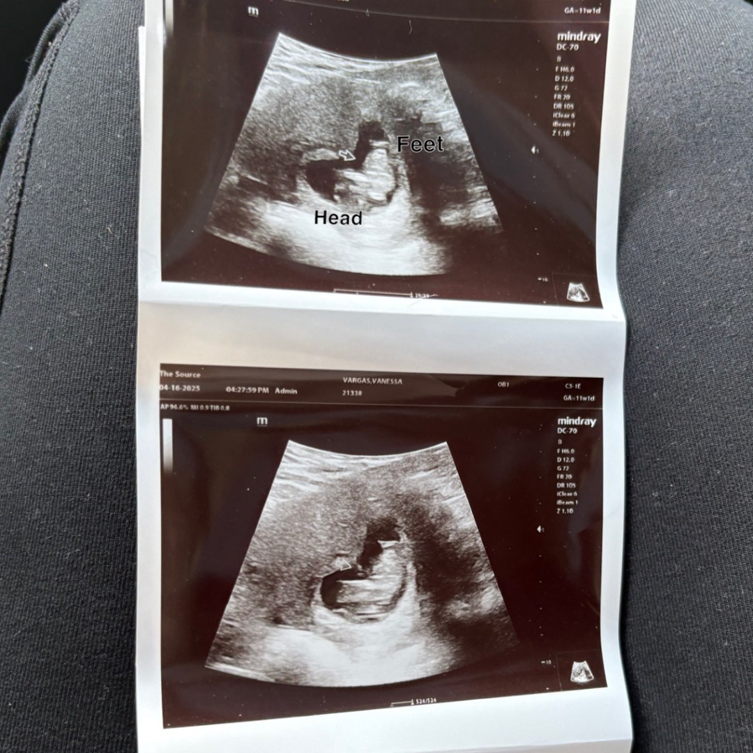 Photo shared by Vanessa for their Babylist baby registry.