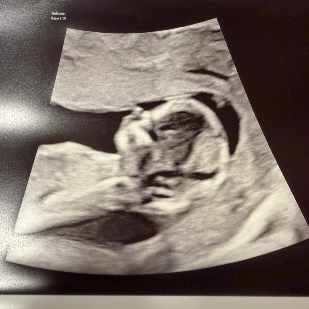 Photo shared by Sammy for their Babylist baby registry.