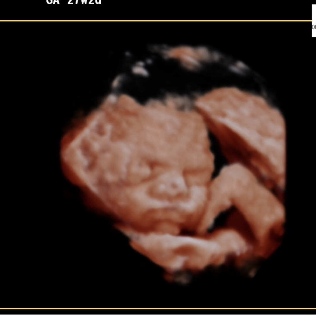 Photo shared by Alyssa for their Babylist baby registry.