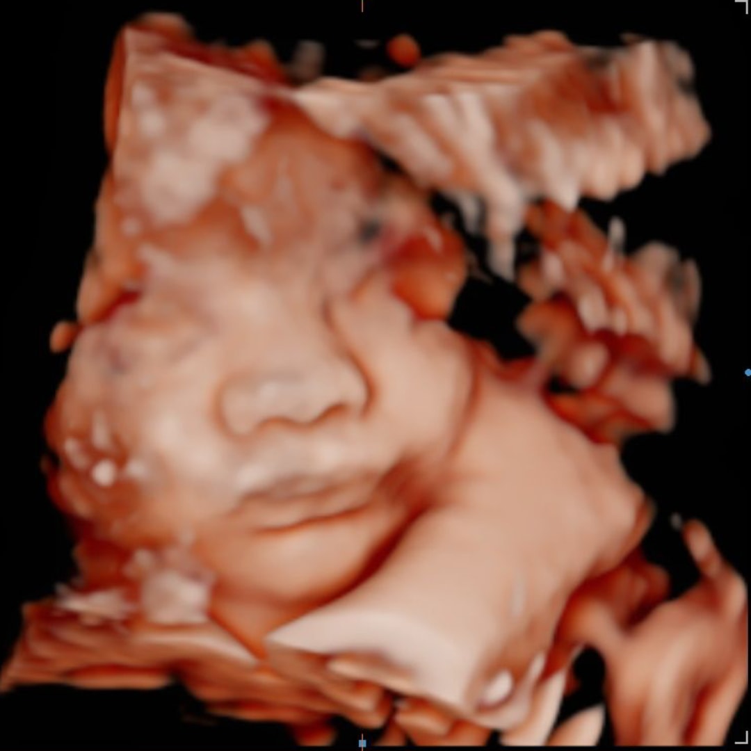 Photo shared by Tara for their Babylist baby registry.