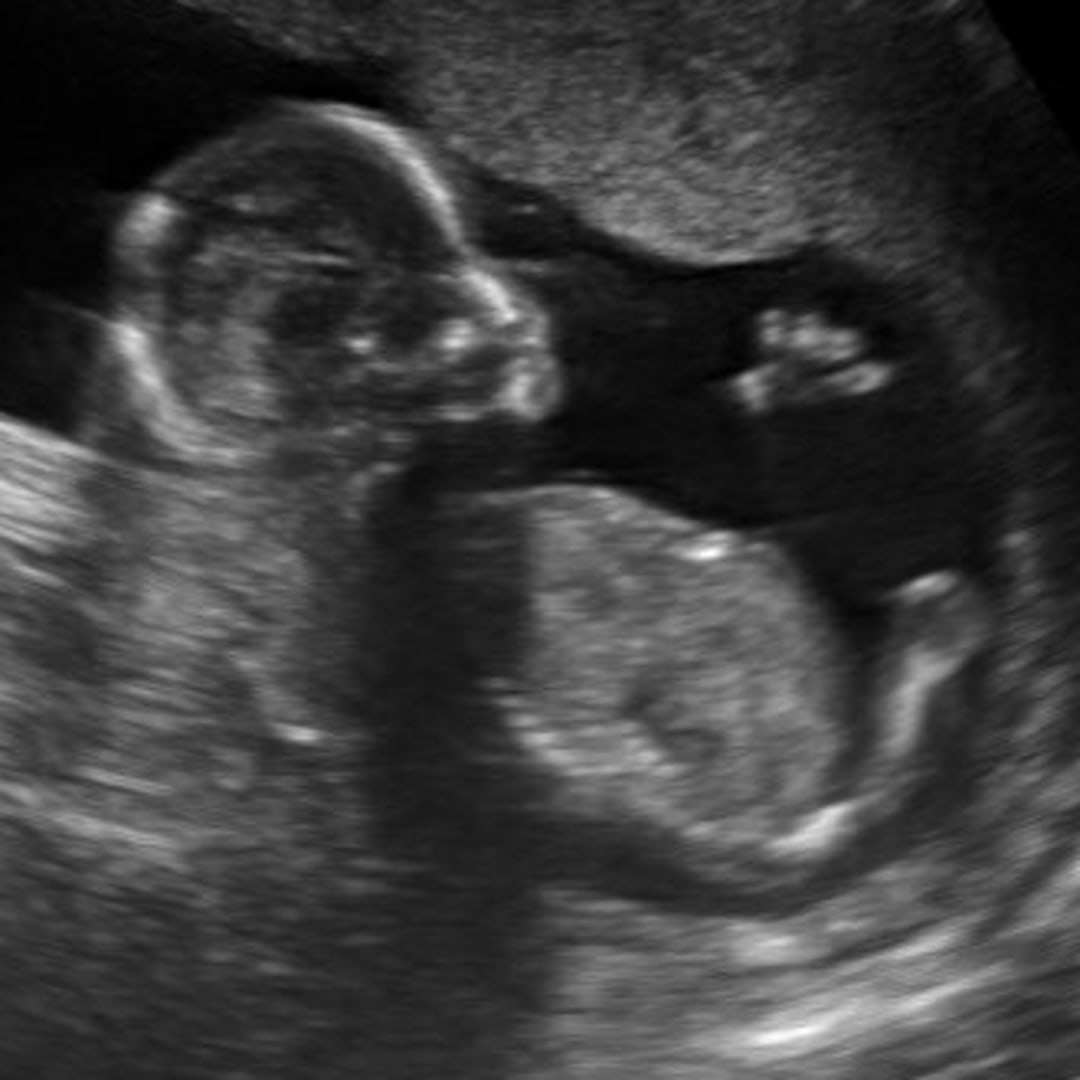 Photo shared by Erin for their Babylist baby registry.