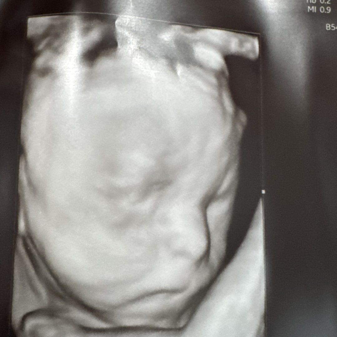 Photo shared by Kirsten for their Babylist baby registry.