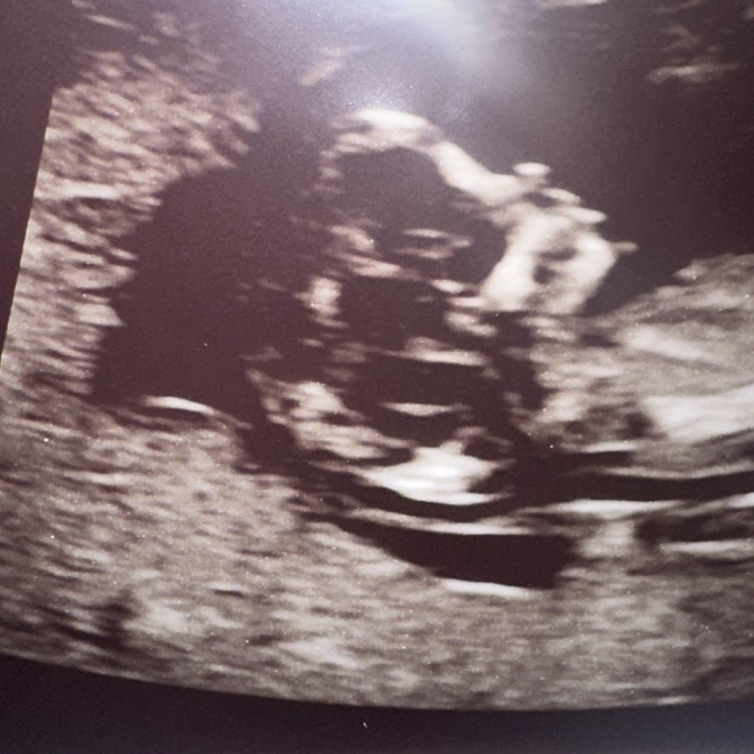 Photo shared by Yeimny for their Babylist baby registry.