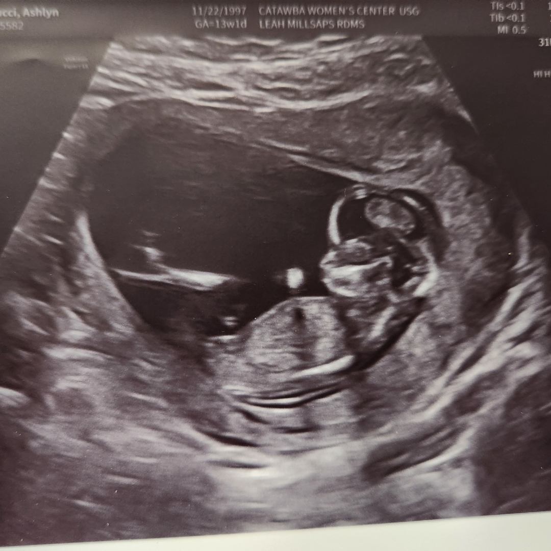 Photo shared by Ashlyn for their Babylist baby registry.