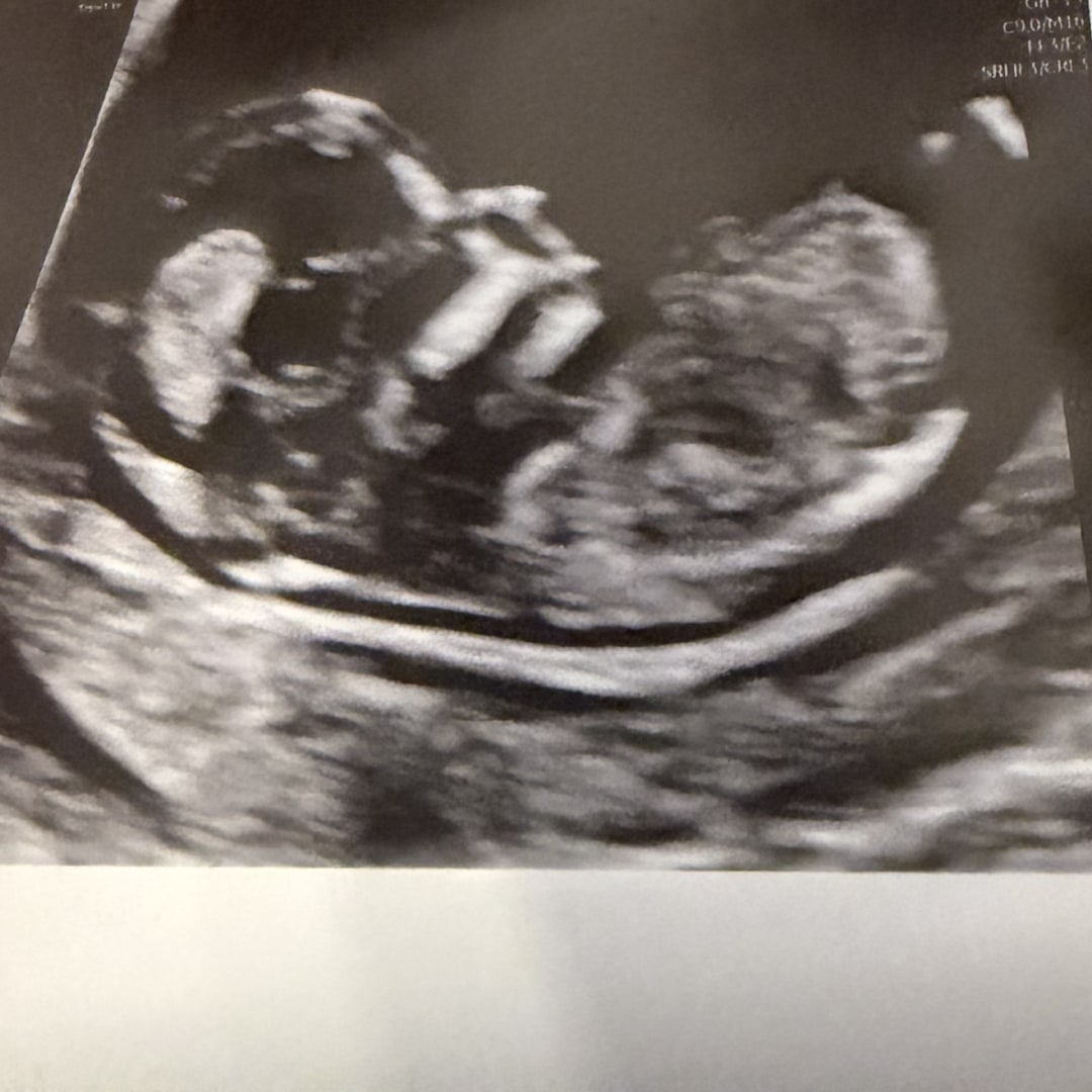 Photo shared by Katherine for their Babylist baby registry.