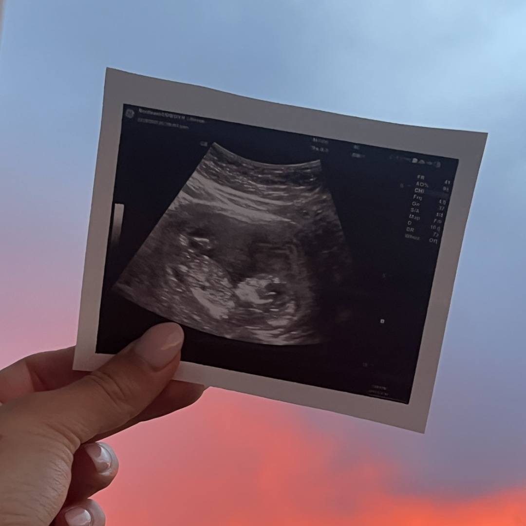 Photo shared by Lauren for their Babylist baby registry.