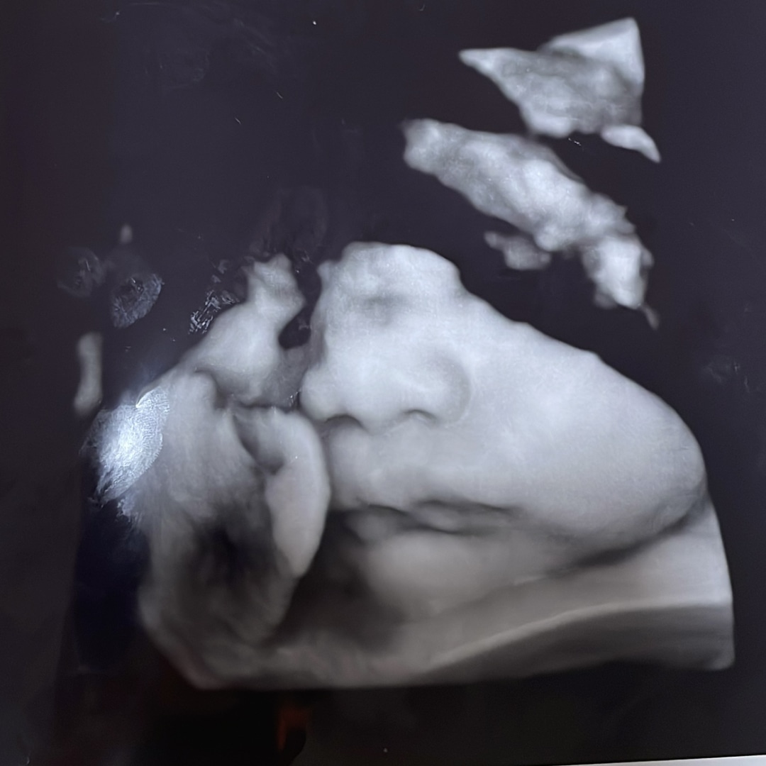 Photo shared by Elysse for their Babylist baby registry.