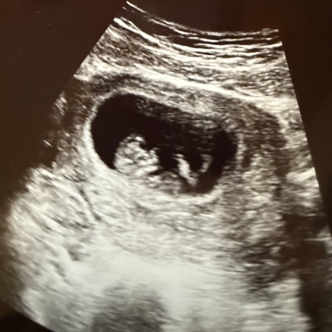 Photo shared by Keiara for their Babylist baby registry.