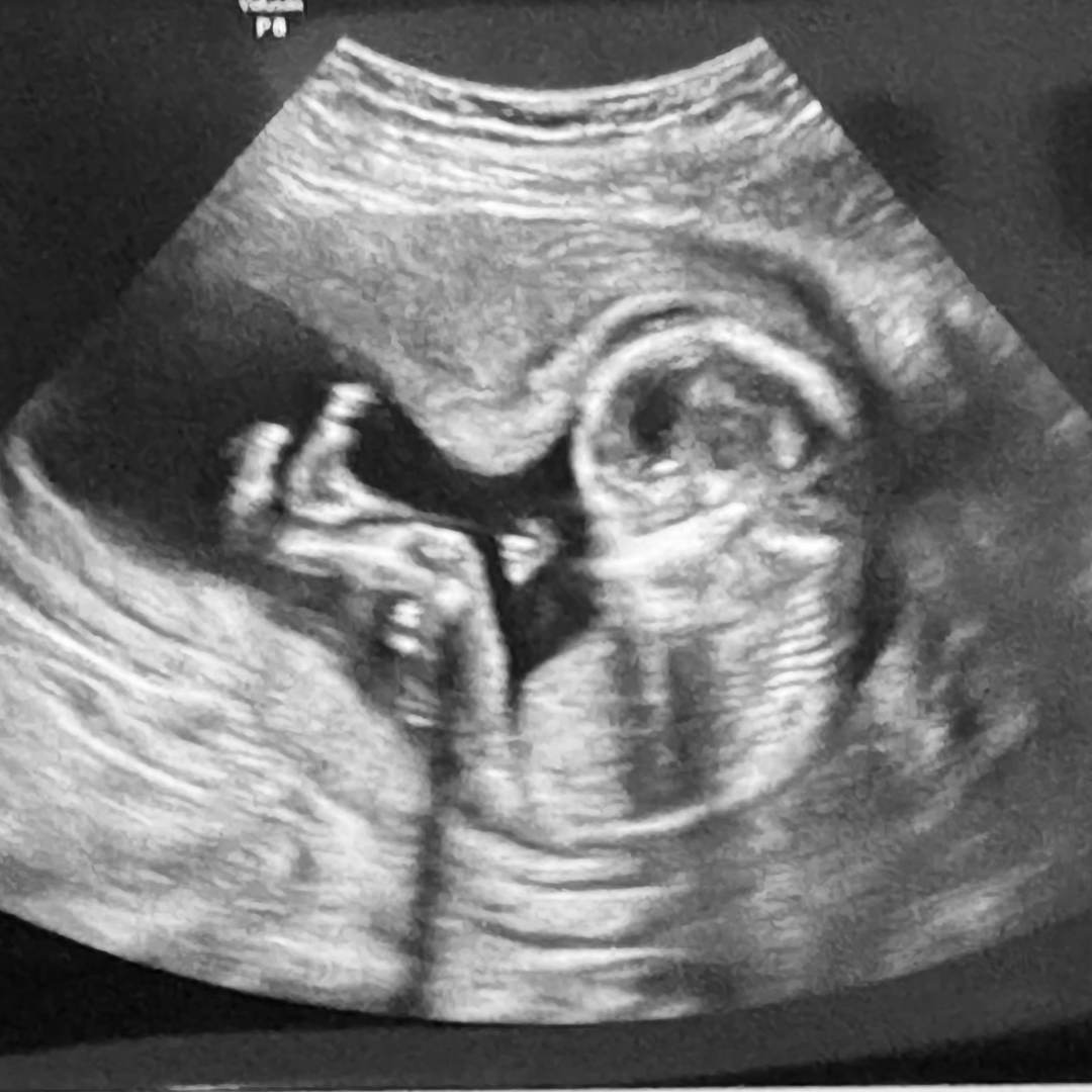 Photo shared by Raleigh for their Babylist baby registry.