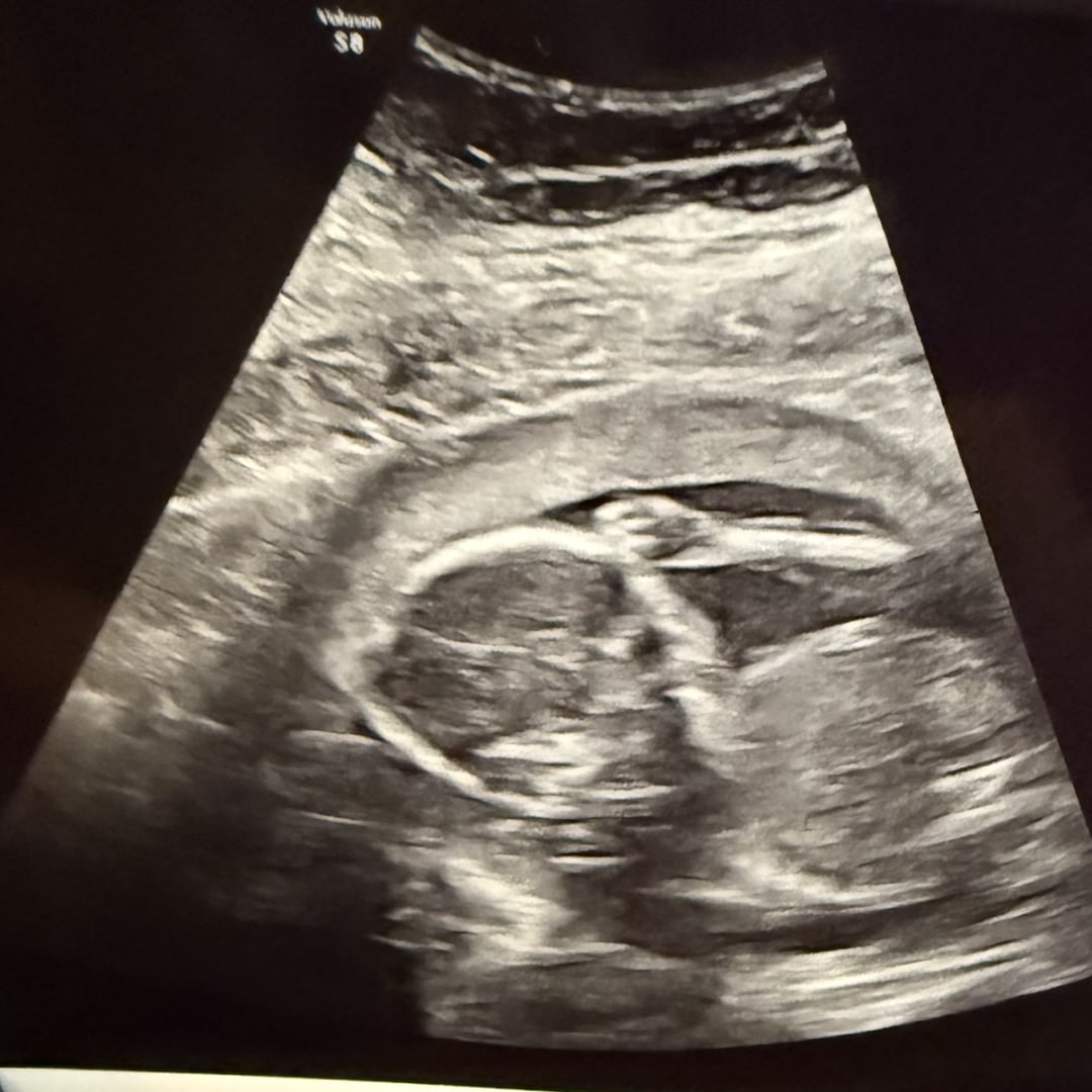 Photo shared by Hannah for their Babylist baby registry.