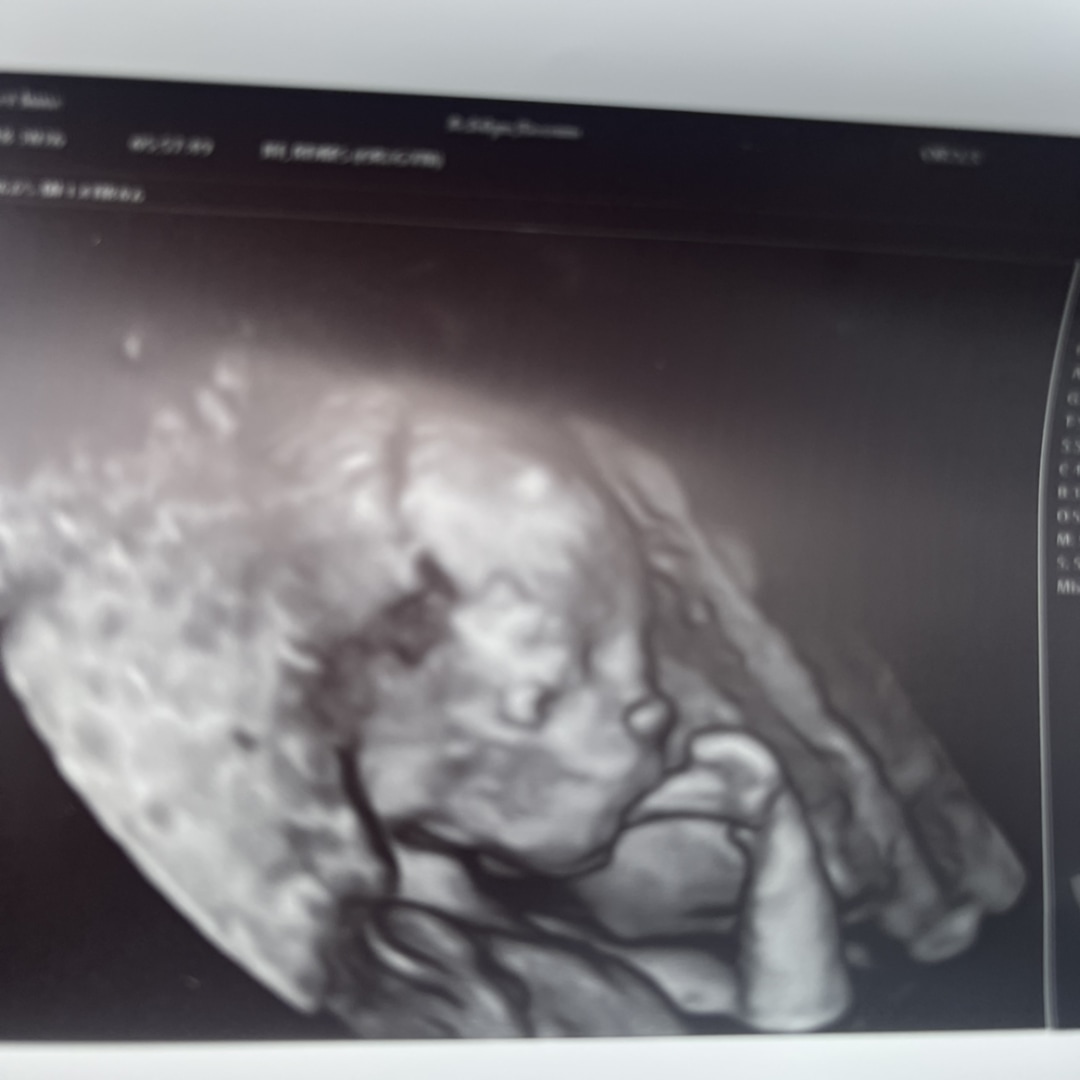 Photo shared by Ashlyn for their Babylist baby registry.