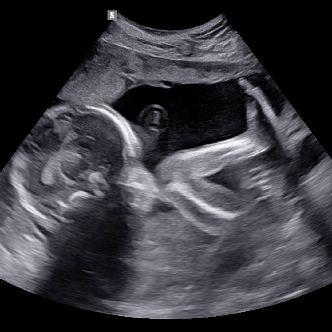 Photo shared by Anissa for their Babylist baby registry.