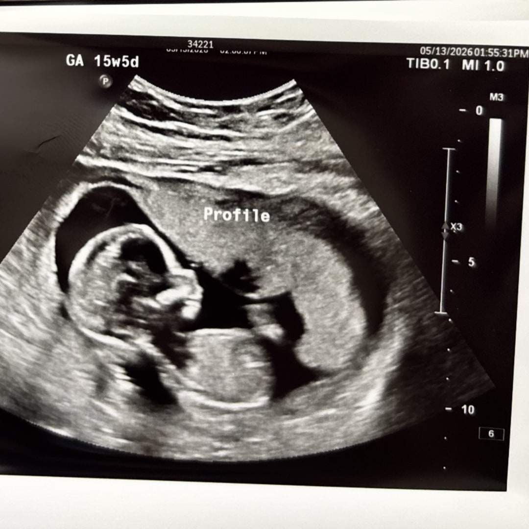 Photo shared by Bailey for their Babylist baby registry.