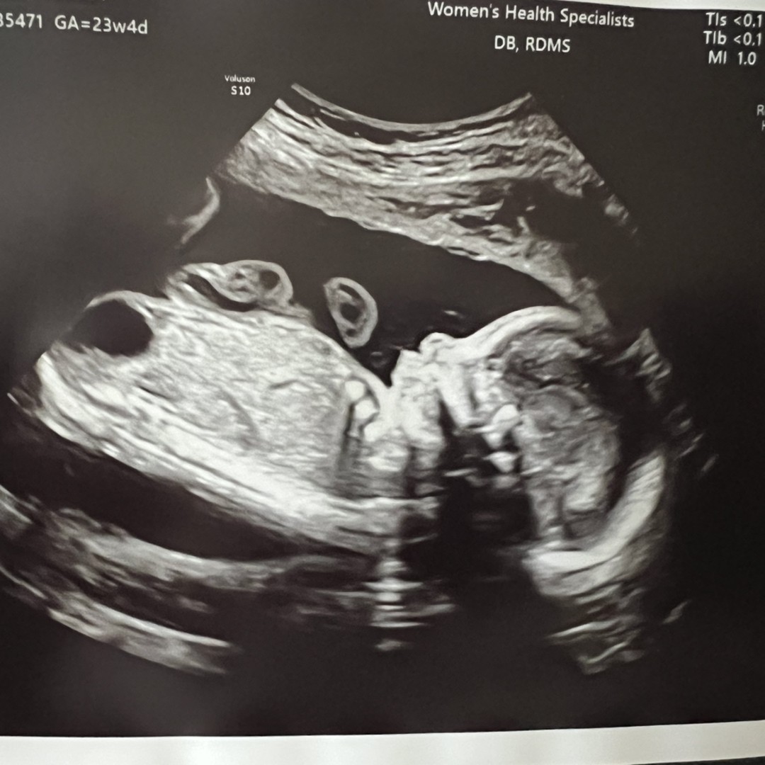 Photo shared by Melody for their Babylist baby registry.
