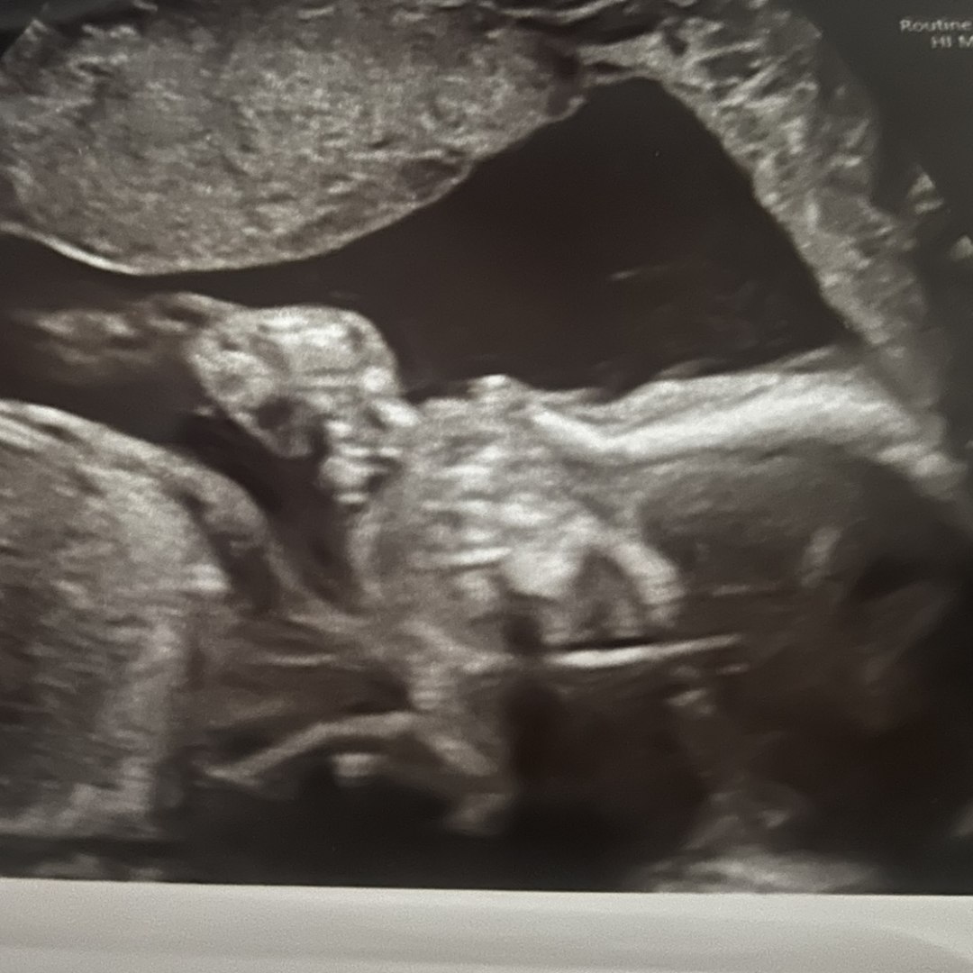 Photo shared by Christa for their Babylist baby registry.