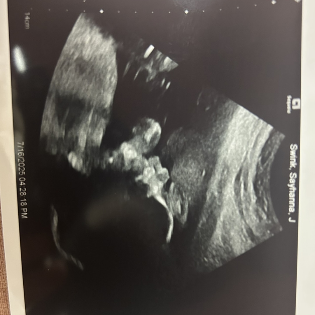 Photo shared by Sayhanna for their Babylist baby registry.