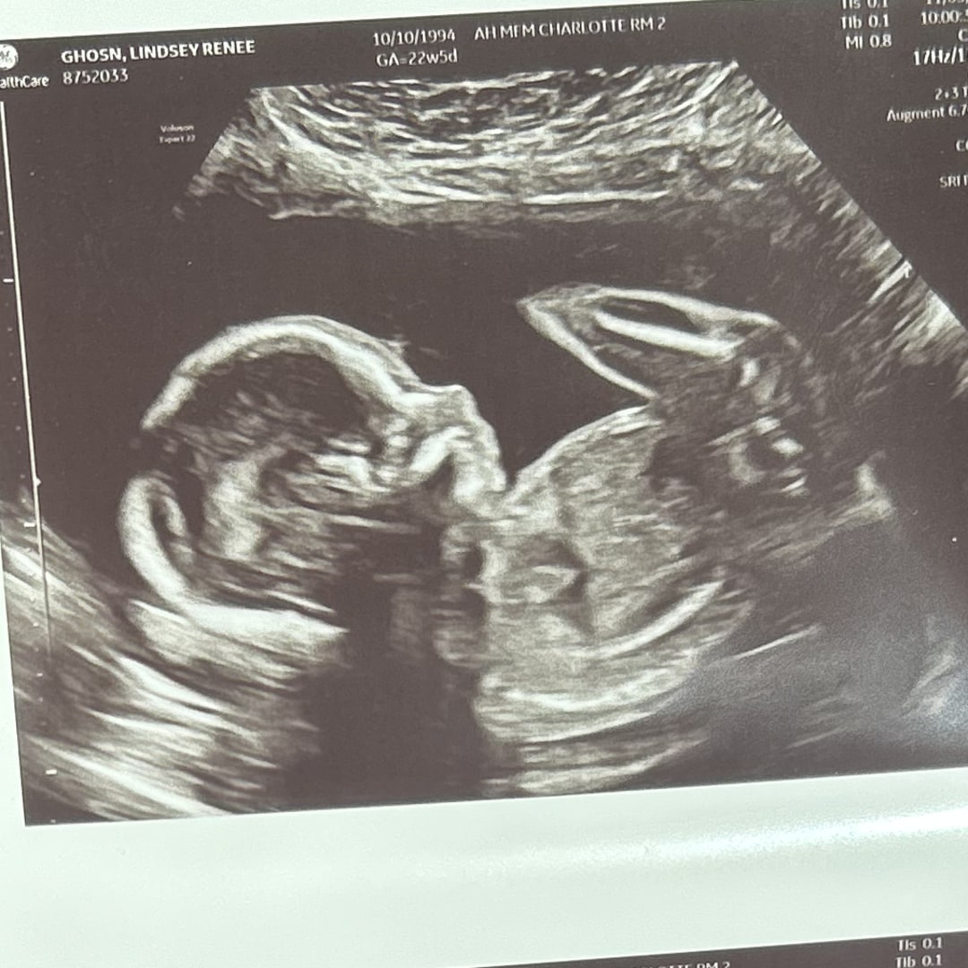 Photo shared by Lindsey for their Babylist baby registry.