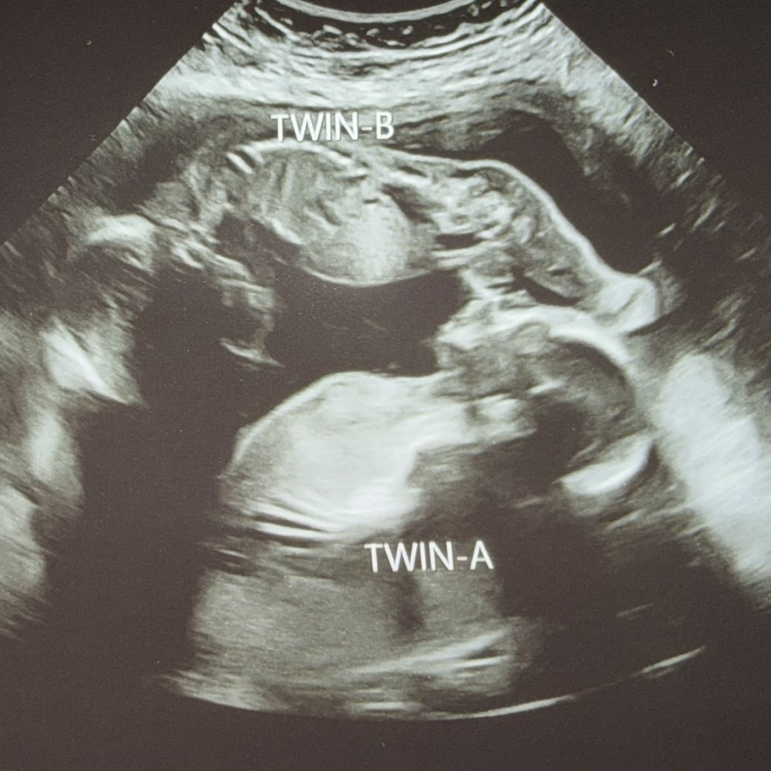 Photo shared by Kara for their Babylist baby registry.