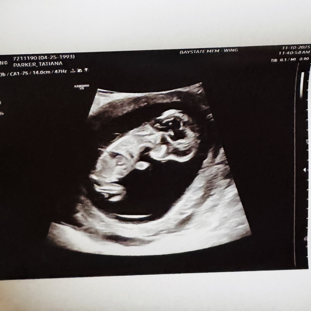 Photo shared by Tatiana for their Babylist baby registry.