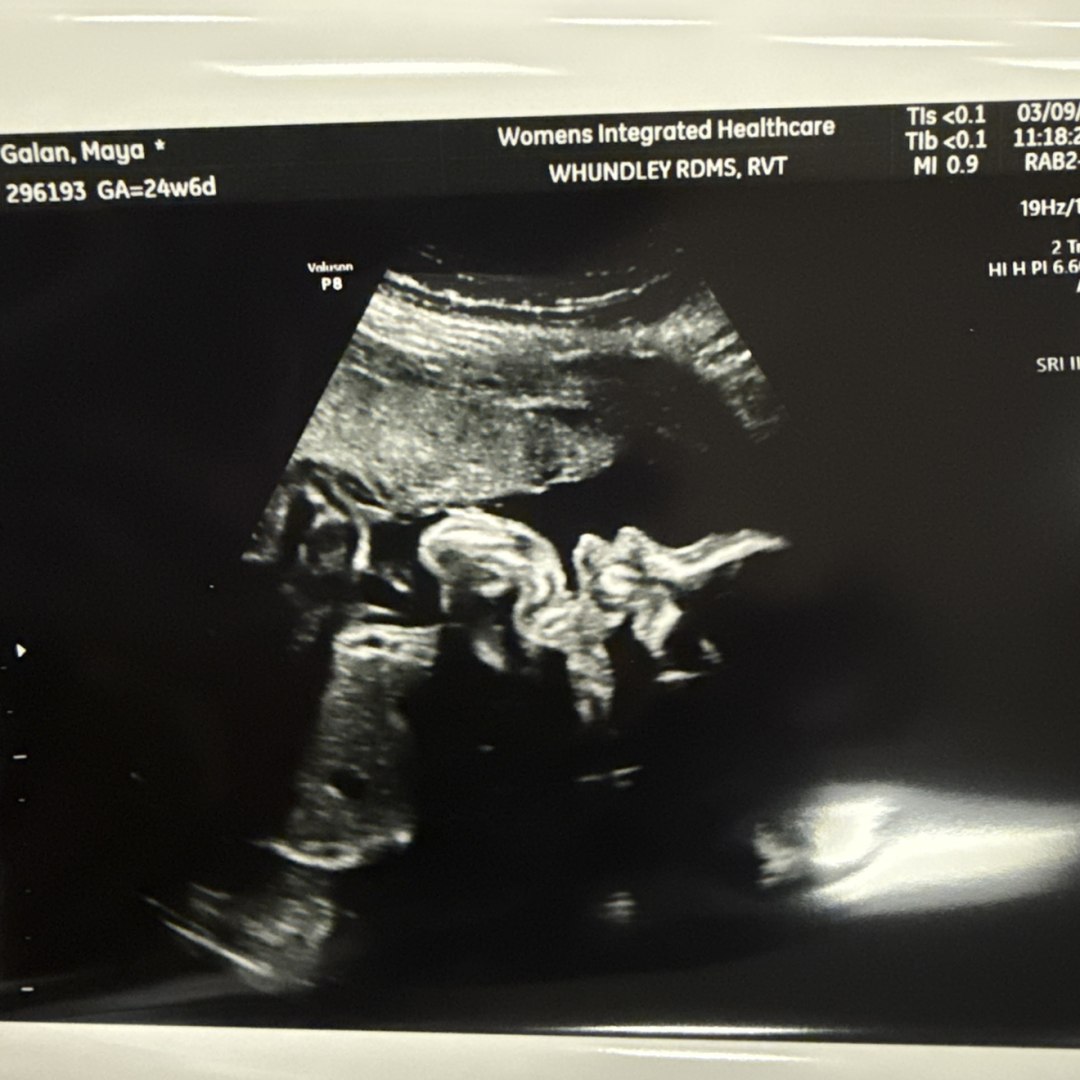 Photo shared by Maya for their Babylist baby registry.