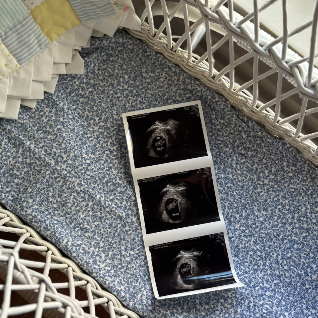 Photo shared by Riley for their Babylist baby registry.