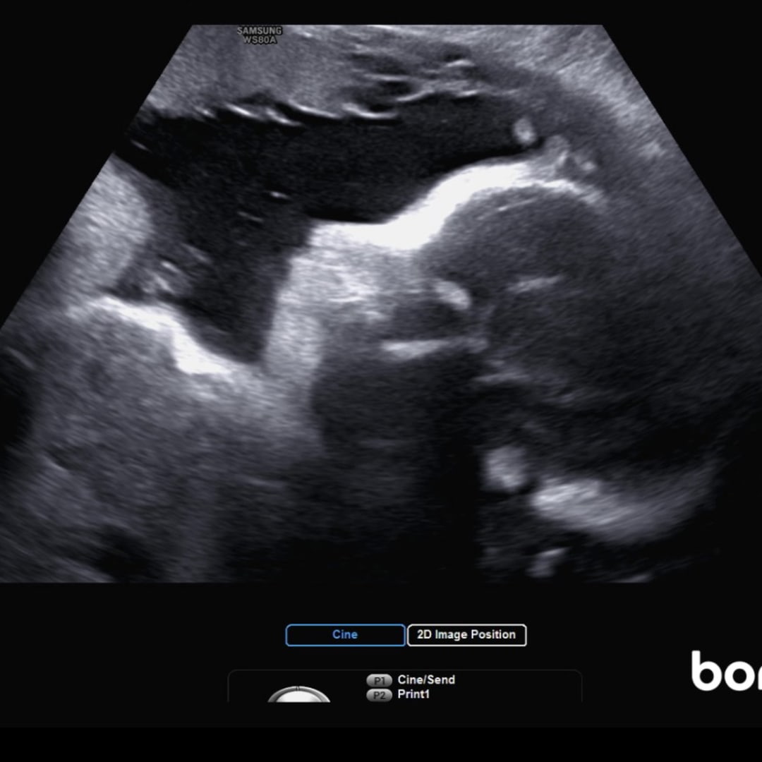 Photo shared by Ayionna for their Babylist baby registry.